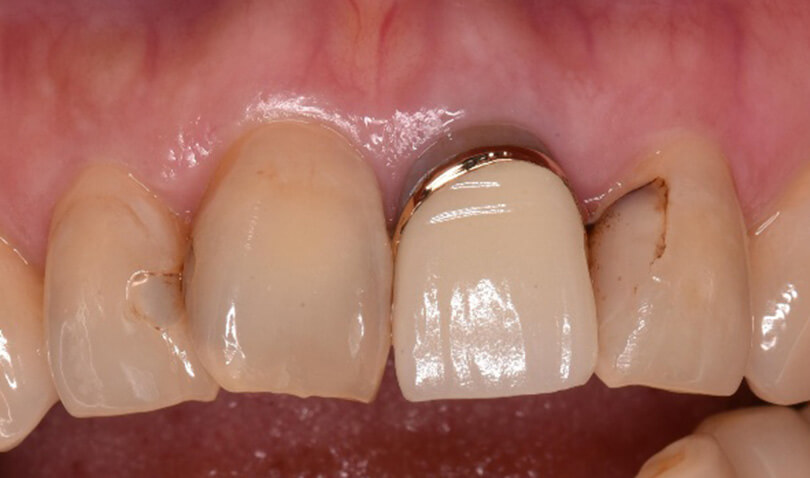 Before